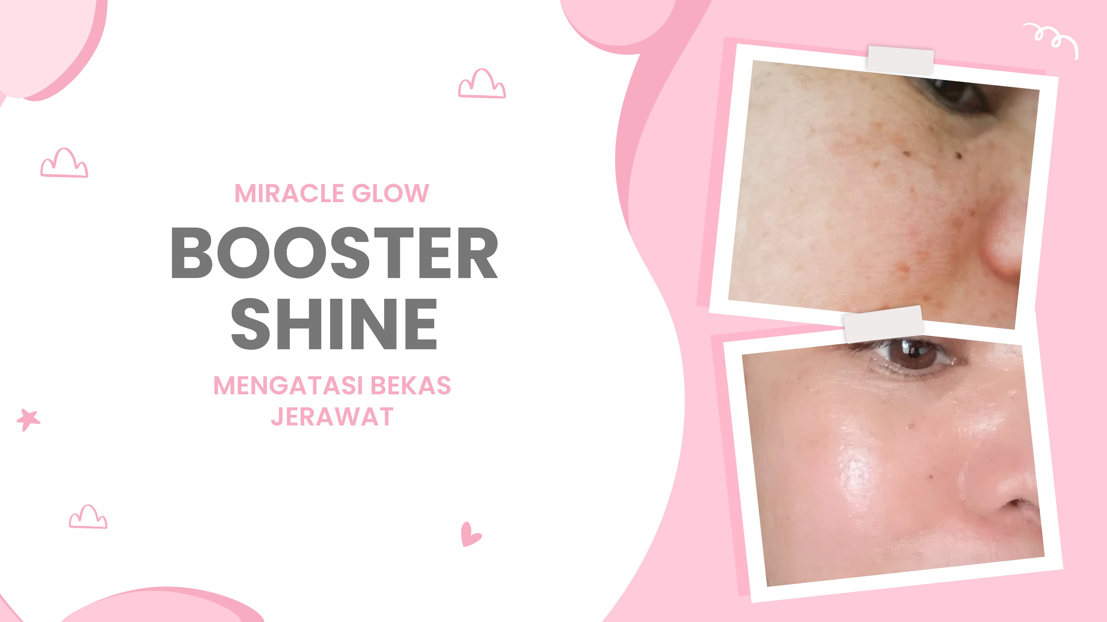 Lulu.id - Booster Shine