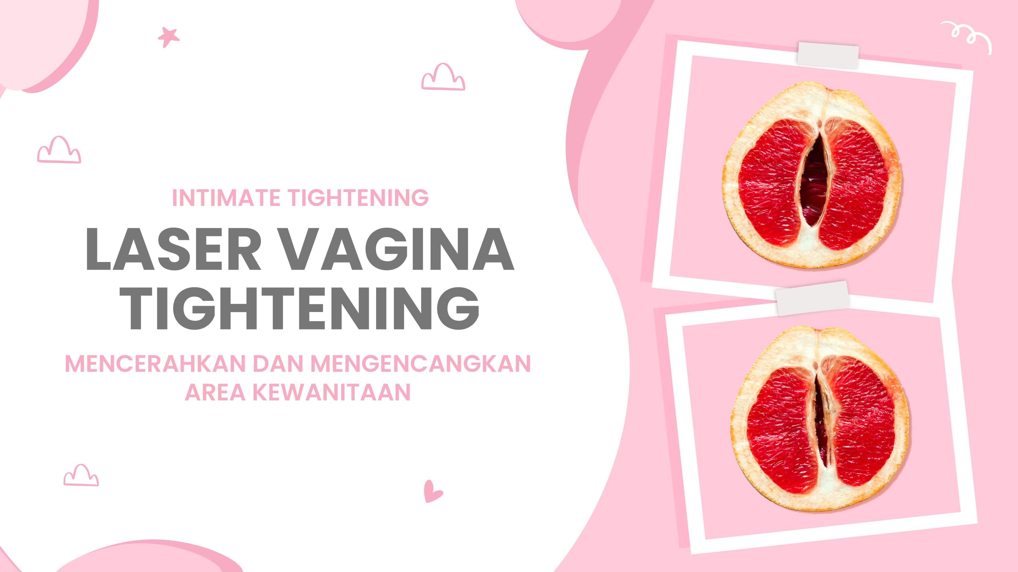 Lulu.id - Laser Vagina Tightening