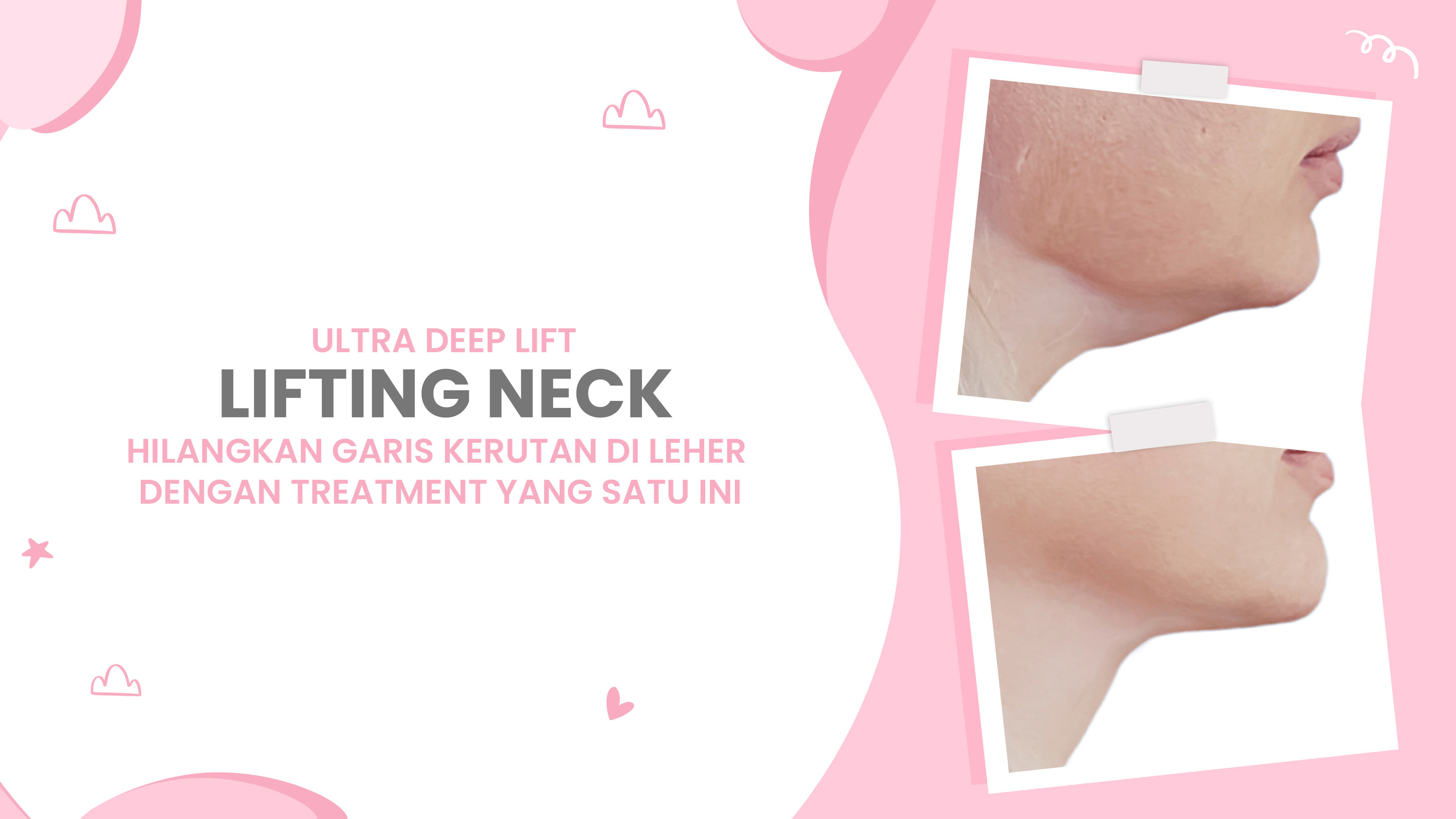 Lulu.id - Neck