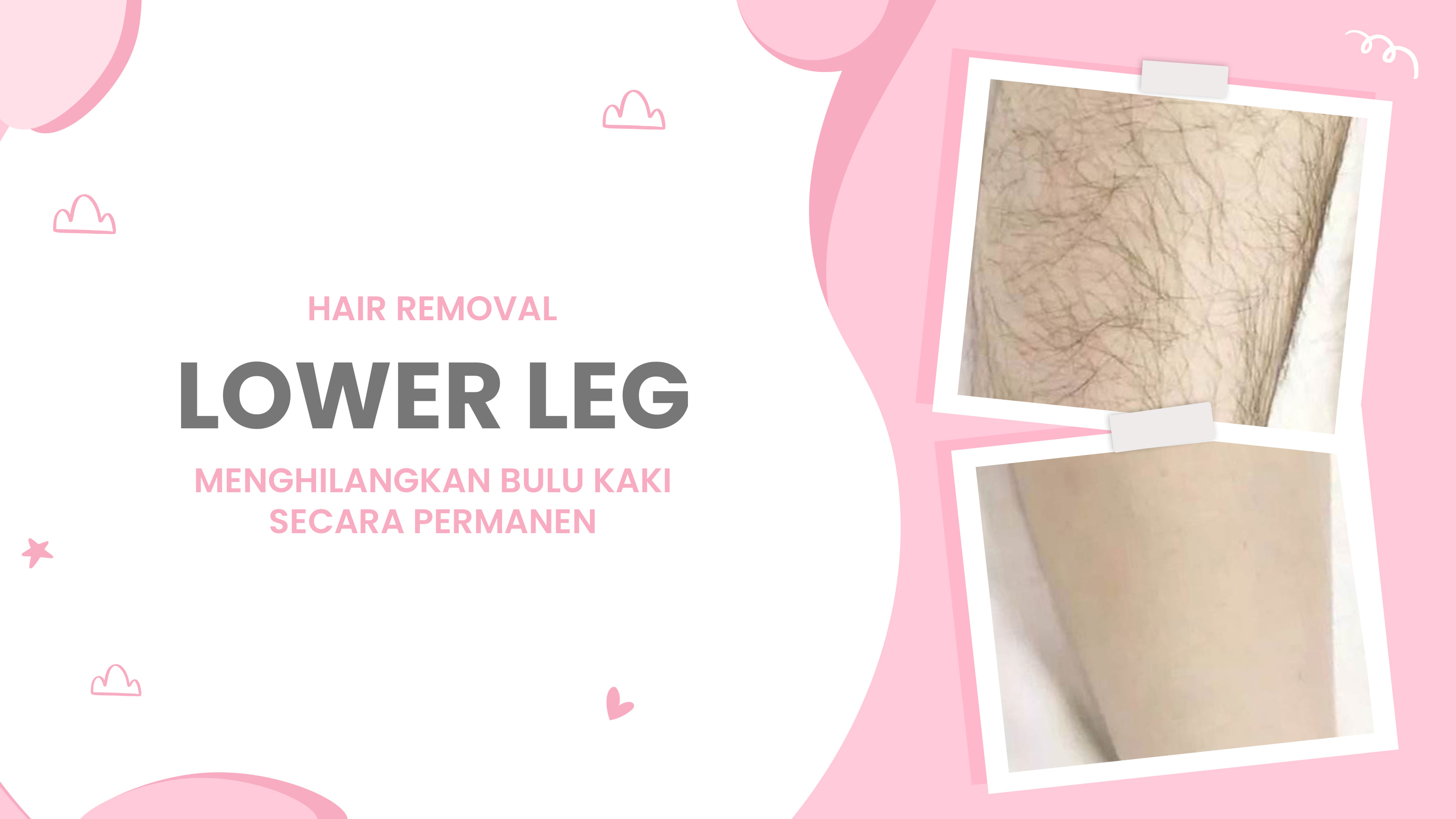 Lulu.id - Lower Leg