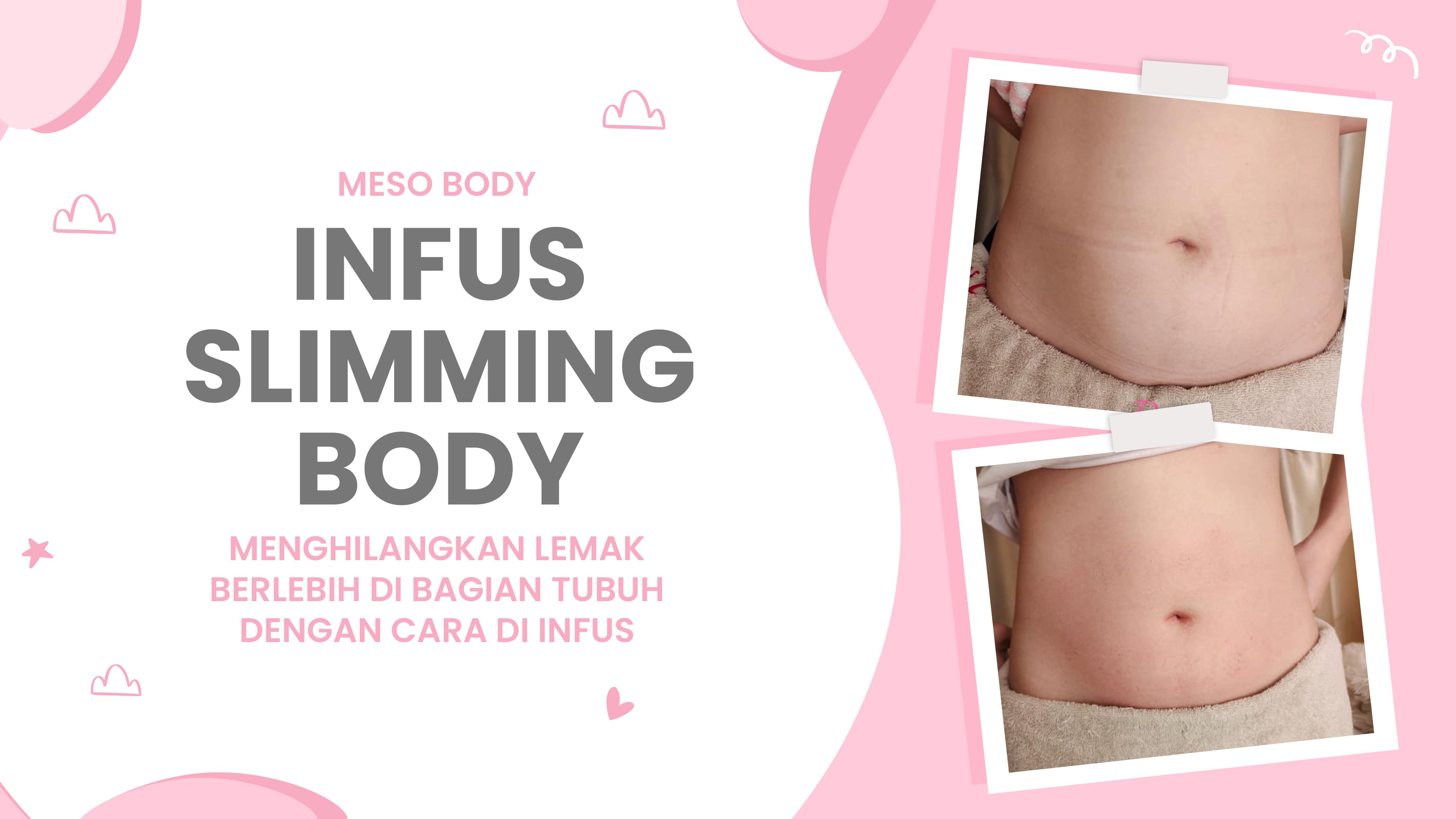 Lulu.id - Infus Slimming Body
