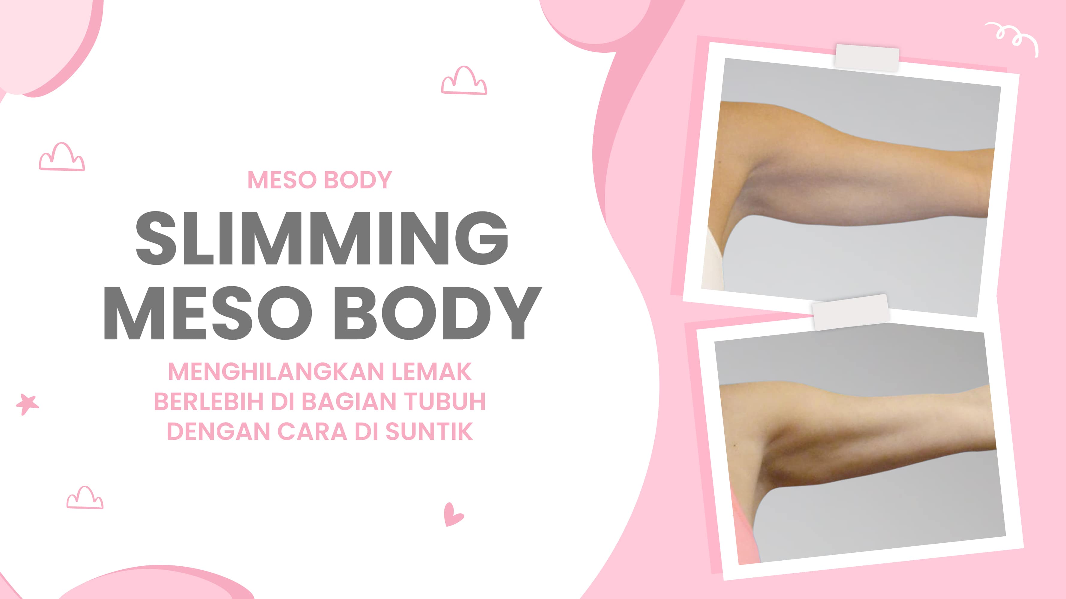Lulu.id - Slimming Meso Body