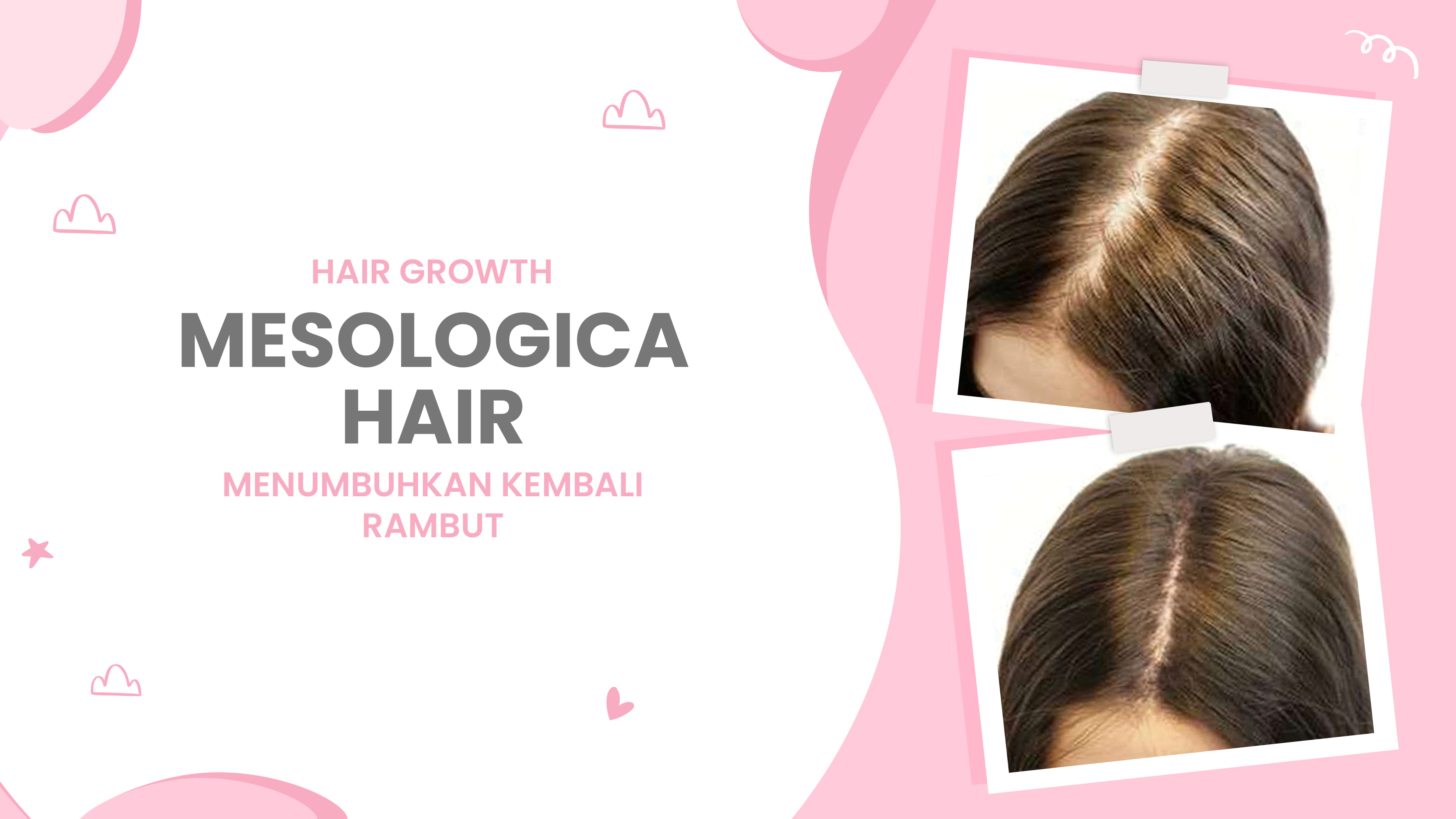 Lulu.id - Mesologica Hair