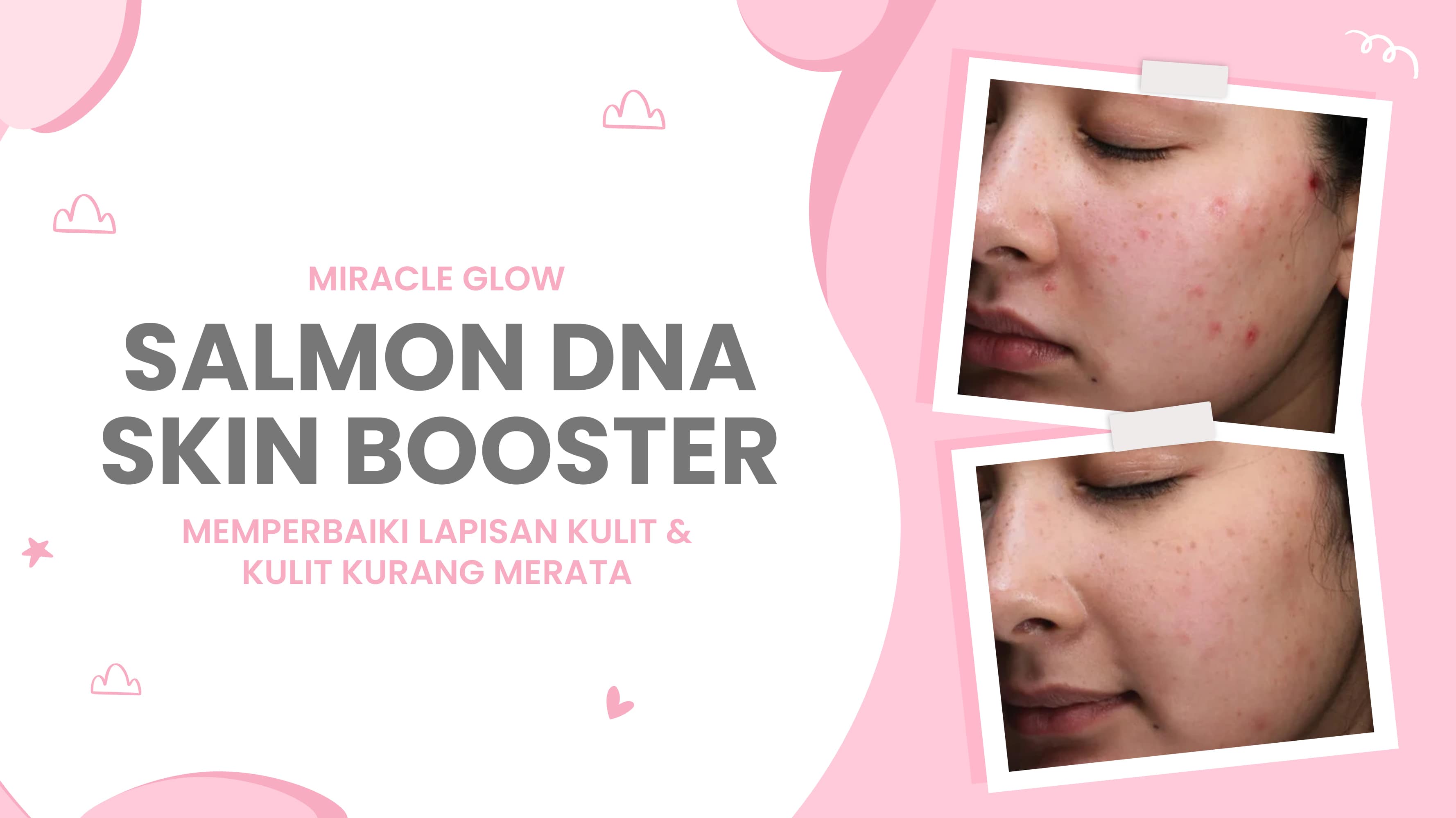 Lulu.id - Salmon DNA Skin Booster