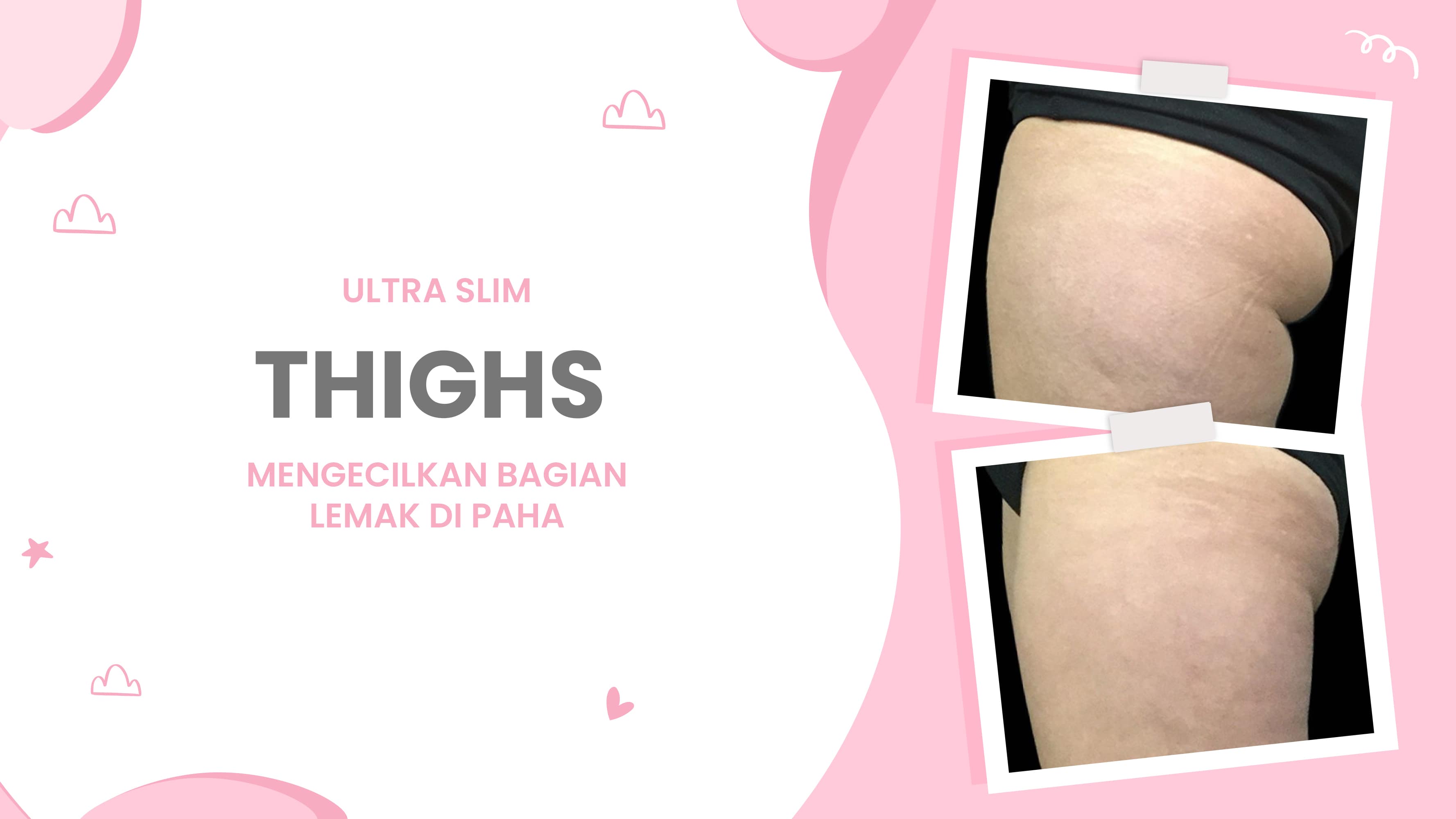 Lulu.id - Thighs