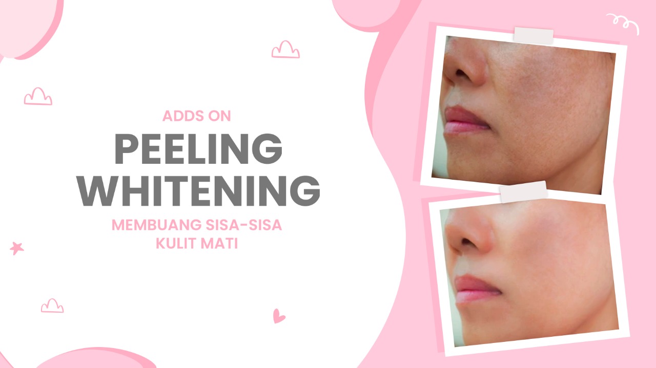 Lulu.id - Peeling Whitening